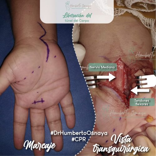 Caso 4