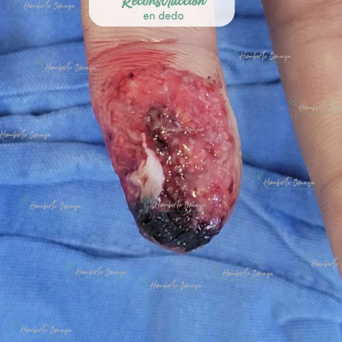 Caso 5