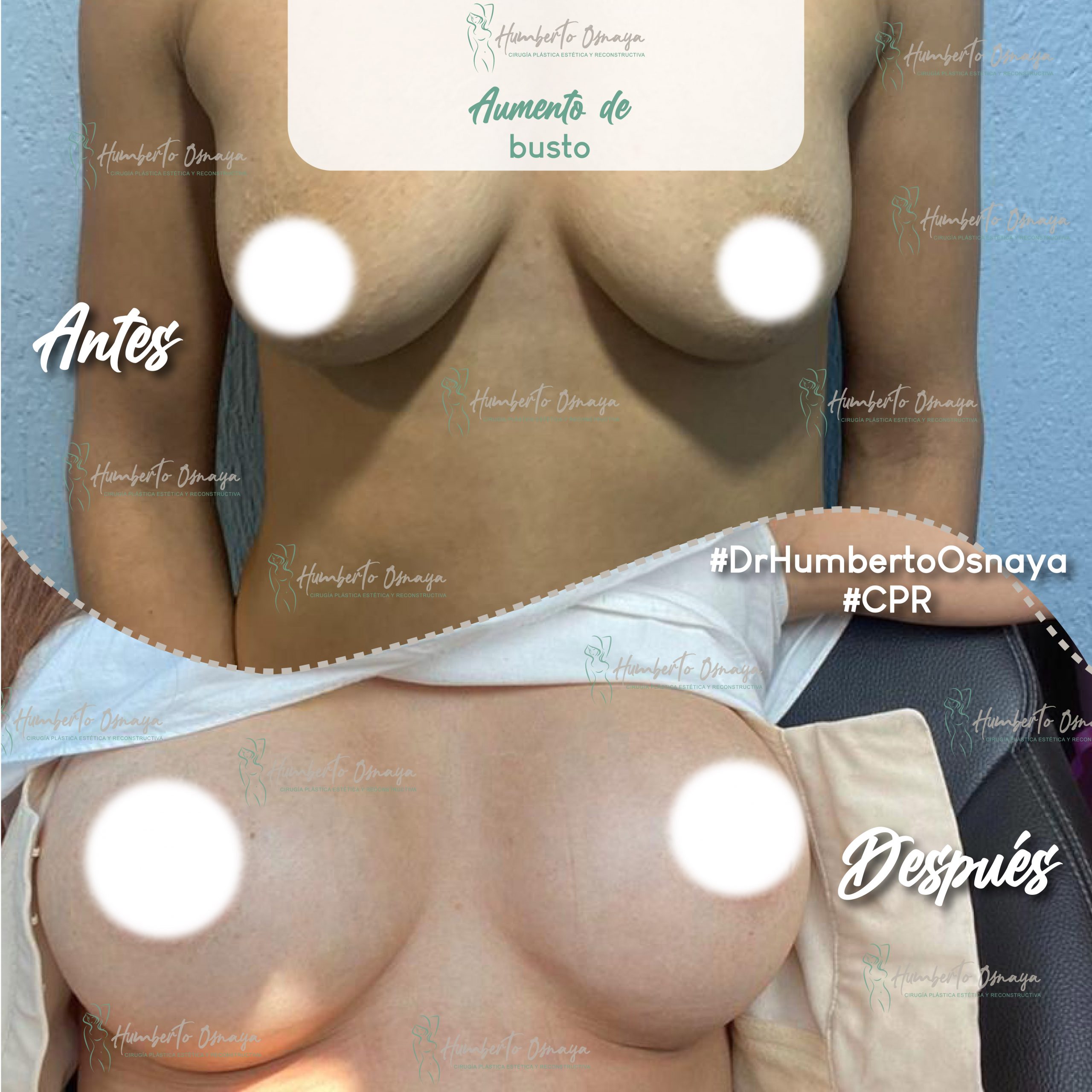 Caso 5