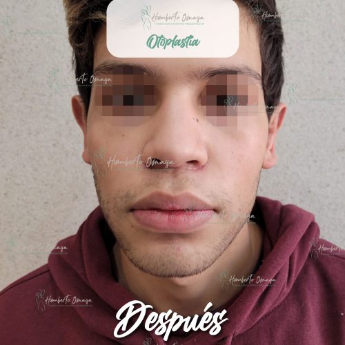 Caso 1