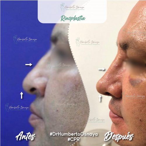 Antes y después