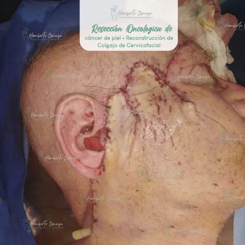 Caso 7
