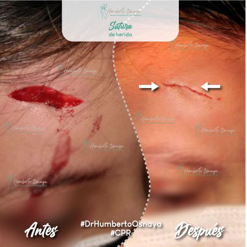 Caso 1