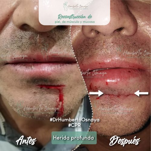 Caso 7